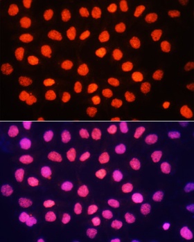 TriMethyl-Histone H3-K64 pAb