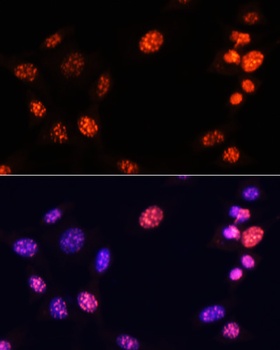 TriMethyl-Histone H3-K64 pAb