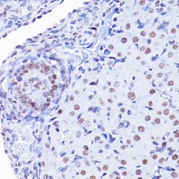 H4K8ac Antibody