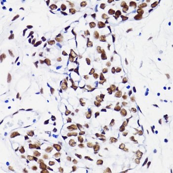 H4K8ac Antibody