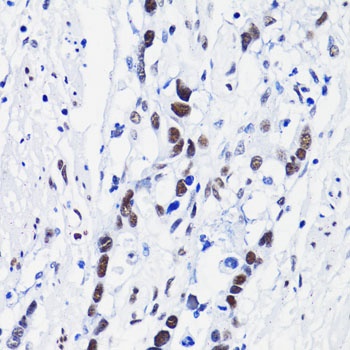 H4K8ac Antibody