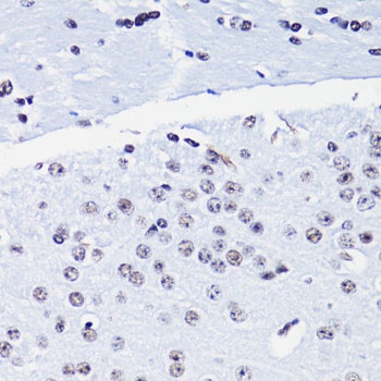 H4K8ac Antibody