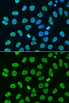 H4K8ac Antibody
