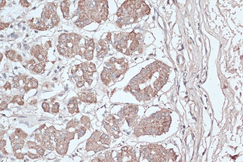 H3K18ac Antibody