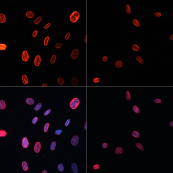 H3K18ac Antibody