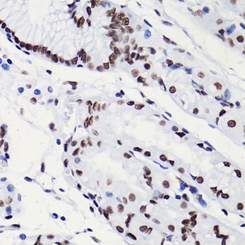 H3K18ac Antibody