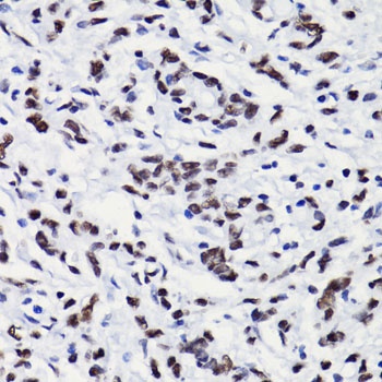 H3K18ac Antibody