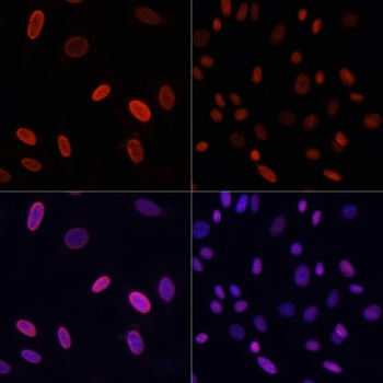 H3K18ac Antibody