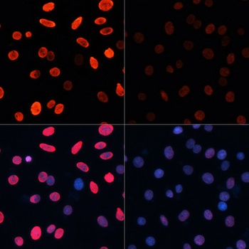 H3K18ac Antibody