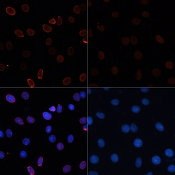 Acetyl-Histone H3-K56 pAb