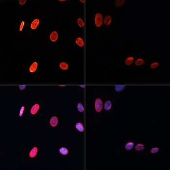 Acetyl-Histone H3-K56 pAb