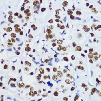 Acetyl-Histone H3-K9 pAb