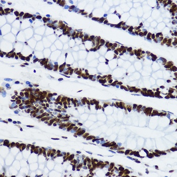 Acetyl-Histone H3-K9 pAb