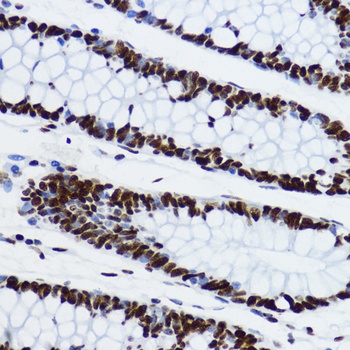 H3K9ac Antibody