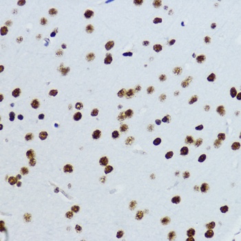 Acetyl-Histone H3-K9 pAb