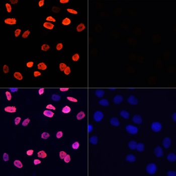 Acetyl-Histone H3-K9 pAb
