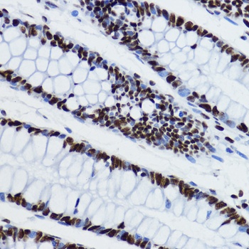 H3K27ac Antibody