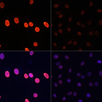 H3K27ac Antibody