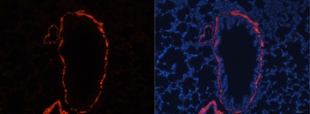 ACTA2 Antibody