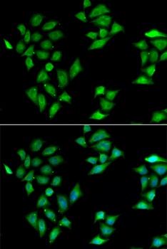 ITLN1 Antibody