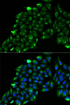 ACADS Antibody
