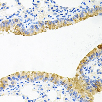 TOB2 Antibody
