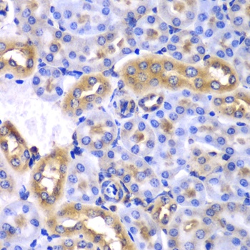 SYNCRIP Antibody