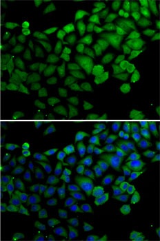 SYNCRIP Antibody