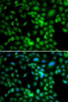 SYCE1 Antibody