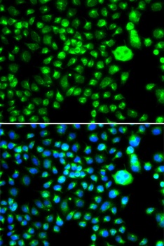 SMCHD1 Antibody