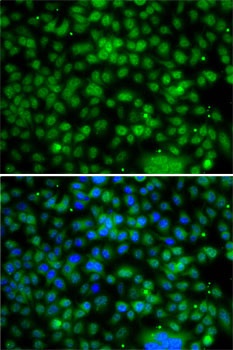 PHYHD1 Antibody