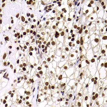 PHIP Antibody