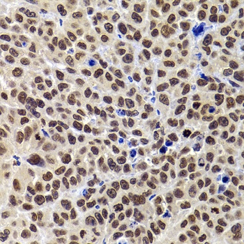 PHIP Antibody