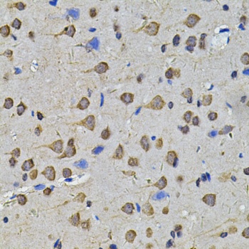 N6AMT1 Antibody