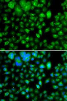 METTL7B Antibody