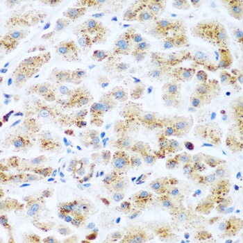 KIAA1456 Antibody