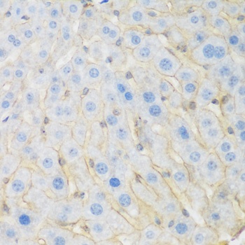 KIAA1456 Antibody