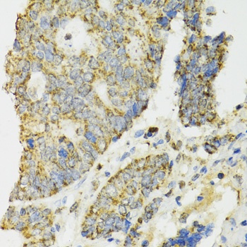 IDH2 Antibody