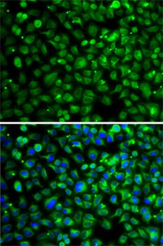 IDH2 Antibody
