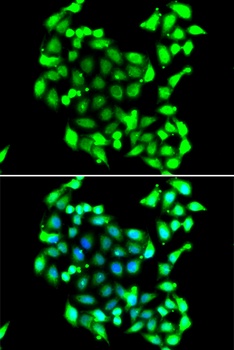 GTF2H3 Antibody