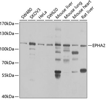 EPHA2 Antibody