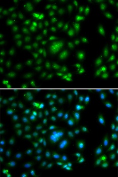 ELF5 Antibody