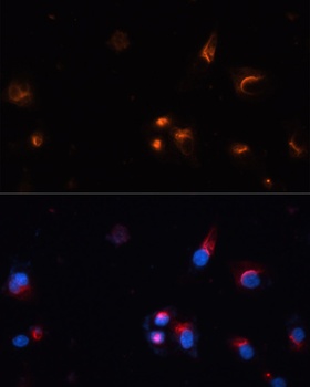 GRIN1 Antibody