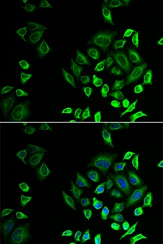 PLA2G2D Antibody