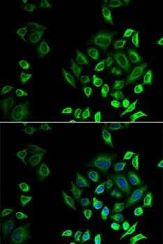 PLA2G2D Antibody