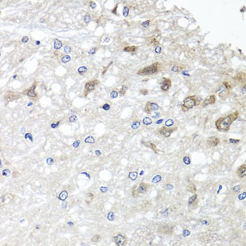 METTL20 Antibody