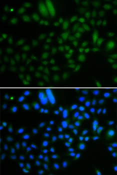 ALKBH8 Antibody