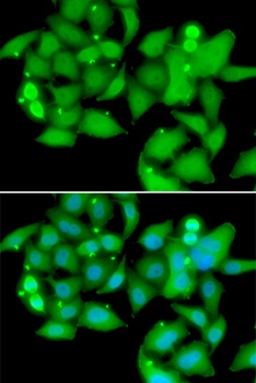 UBASH3B Antibody