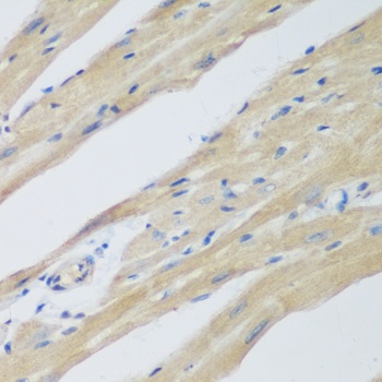 WDR77 Antibody