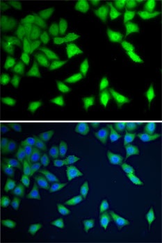 WDR77 Antibody